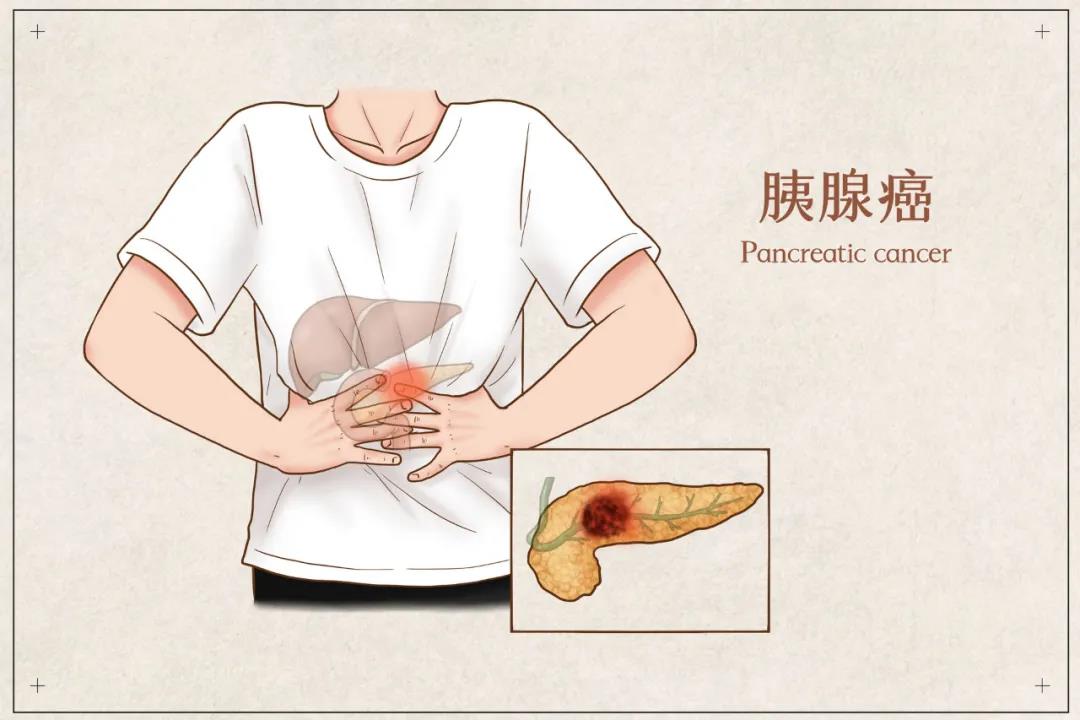 面对“癌王”，只能举手投降？